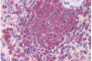 Human Spleen (formalin-fixed, paraffin-embedded) stained with ARPC2 antibody ABIN351464 at 3. (ARPC2 antibody  (AA 288-300))