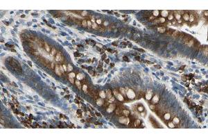 ABIN6274670 at 1/100 staining Mouse intestine tissue by IHC-P. (GRID1 antibody  (Internal Region))