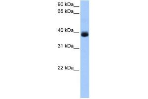 SERPINA5 antibody used at 1 ug/ml to detect target protein. (SERPINA5 antibody  (C-Term))
