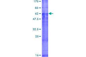 ORCTL-2/SLC22A18 Protein (AA 1-424) (GST tag)