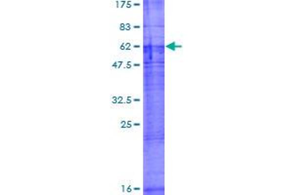 ORCTL-2/SLC22A18 Protein (AA 1-424) (GST tag)