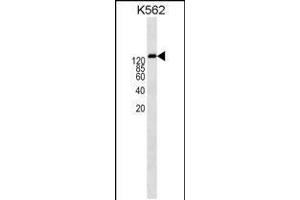 Western blot analysis in K562 cell line lysates (35ug/lane). (P-Glycoprotein antibody  (AA 647-677))