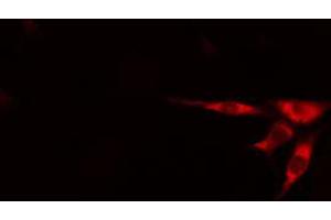 ABIN6273415 staining HepG2 cells by IF/ICC.