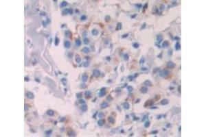 Figure. (BIN2 antibody  (AA 1-244))