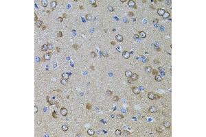 Immunohistochemistry of paraffin-embedded rat brain using GM13125 antibody. (Pramel15 antibody)