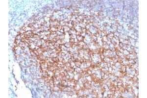 Formalin-fixed, paraffin-embedded human Tonsil stained with CD35 Mouse Monoclonal Antibody (SPM554).