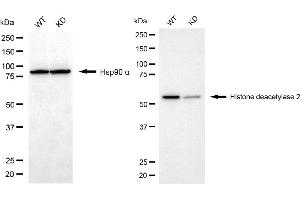 Western blotting analysis using histone deacetylase 2 antibody (ABIN7798931). (Recombinant HDAC2 antibody)