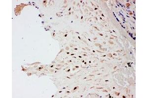 Immunohistochemistry (IHC) image for anti-Protein Inhibitor of Activated STAT, 1 (PIAS1) (AA 636-651) antibody (ABIN3032369)