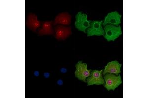 ABIN6258571 and ABIN6274564 staining Hela cells by IF/ICC. (14-3-3 eta antibody  (Internal Region))