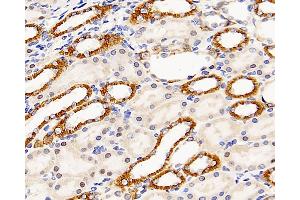 Immunohistochemistry analysis of paraffin-embedded rat kidney using Mineralocorticoid receptor Polyclonal Antibody at dilution of 1:300. (NR3C2 antibody)