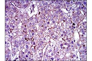 Flow cytometric analysis of HepG2 cells using ABCB5 antibody (green) and negative control (purple). (ABCB5 antibody  (AA 481-674))