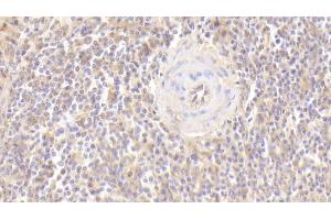 Immunohistochemistry (IHC) image for anti-CD40 Ligand (CD40LG) (AA 1-261) antibody (ABIN7442618)