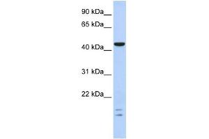 WB Suggested Anti-BTBD6 Antibody Titration:  0. (BTBD6 antibody  (Middle Region))