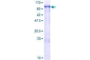 Image no. 1 for Synovial Sarcoma, X Breakpoint 2 Interacting Protein (SSX2IP) (AA 1-614) protein (GST tag) (ABIN1321455) (SSX2IP Protein (AA 1-614) (GST tag))