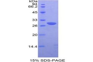 SDS-PAGE analysis of Mouse Pim-2 Oncogene Protein. (PIM2 Protein)