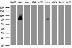 Image no. 2 for anti-Galactosidase, beta 1 (GLB1) antibody (ABIN1498466)