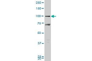 PROX1 monoclonal antibody (M09), clone 1H6 Western Blot analysis of PROX1 expression in MCF-7 .