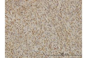 Immunoperoxidase of monoclonal antibody to BUB1B on formalin-fixed paraffin-embedded human spleen. (BUB1B antibody  (AA 1-130))
