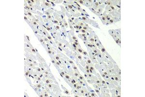 Immunohistochemistry (Paraffin-embedded Sections) (IHC (p)) image for anti-Splicing Factor 3b, Subunit 2, 145kDa (SF3B2) (AA 616-895) antibody (ABIN6147666)