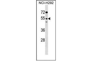 Western blot analysis of D172g / SIRPG in NCI-H292 cell line lysates (35ug/lane). (SIRPG antibody  (Middle Region))