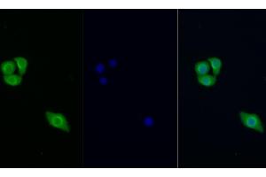 Detection of PIK3Cb in Human Hela cell using Polyclonal Antibody to Phosphoinositide-3-Kinase Catalytic Beta Polypeptide (PIK3Cb) (PIK3CB antibody  (AA 807-1070))