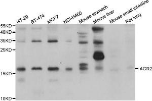Western blot analysis of extracts of various cell lines, using AGR2 antibody (ABIN5975470) at 1/1000 dilution. (AGR2 antibody)