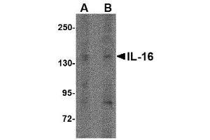Image no. 1 for anti-Interleukin 16 (IL16) (N-Term) antibody (ABIN341724) (IL16 antibody  (N-Term))