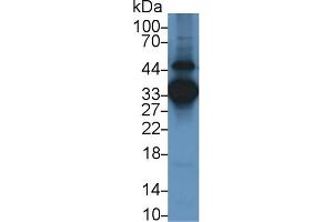 Detection of ANXA3 in Human Lung lysate using Monoclonal Antibody to Annexin A3 (ANXA3) (Annexin A3 antibody  (AA 190-312))