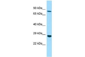 WB Suggested Anti-EMILIN3 Antibody Titration: 1. (EMILIN3 antibody  (C-Term))