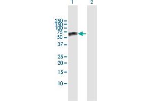 Western Blot analysis of GBA expression in transfected 293T cell line by GBA MaxPab polyclonal antibody. (GBA antibody  (AA 1-536))