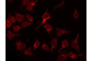 ABIN6266968 staining COLO205 by IF/ICC. (PSMD2 antibody  (Internal Region))