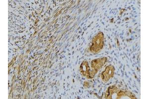ABIN6276487 at 1/100 staining Human uterus tissue by IHC-P.