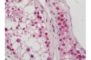Human Testis: Formalin-Fixed, Paraffin-Embedded (FFPE). (CDKN2AIPNL antibody  (FITC))