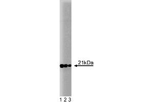 Western blot analysis of Rac1 on a rat cerebrum lysate. (RAC1 antibody)