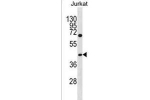 GCNT6 Antibody (C-term) (ABIN1536996 and ABIN2850077) western blot analysis in Jurkat cell line lysates (35 μg/lane). (GCNT6 antibody  (C-Term))