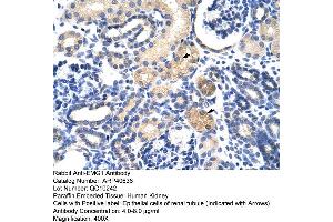 Rabbit Anti-EMG1 Antibody  Paraffin Embedded Tissue: Human Kidney Cellular Data: Epithelial cells of renal tubule Antibody Concentration: 4. (EMG1 antibody  (N-Term))