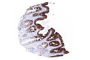 colon descendens mucosa (Recombinant KRT20 antibody  (AA 196-323))