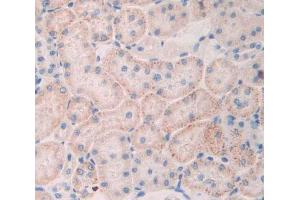 Figure. (TNIP2 antibody  (AA 20-200))