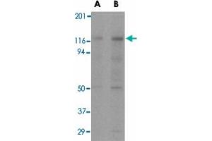Western blot analysis of APAF1 in K-562 cell lysate with APAF1 monoclonal antibody, clone 2E10  at (A) 0. (APAF1 antibody  (C-Term))