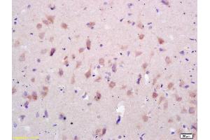 Formalin-fixed and paraffin embedded rat brain labeled with Rabbit Anti GluR1/AMPA Polyclonal Antibody, Unconjugated (ABIN1385842) at 1:200 followed by conjugation to the secondary antibody and DAB staining (GluR1, GluR2 antibody  (AA 141-240))