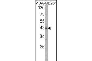 Western blot analysis of USP12/USP46 Antibody (C-term) (ABIN388899 and ABIN2839185) in MDA-M cell line lysates (35 μg/lane). (USP12,USP46 (AA 315-345), (C-Term) antibody)
