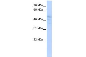 DLL3 antibody used at 1 ug/ml to detect target protein. (DLL3 antibody)