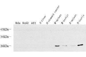 Western Blot analysis of various samples using p19 INK4d Polyclonal Antibody at dilution of 1:500. (CDKN2D antibody)