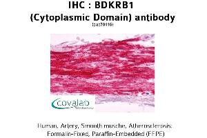 Image no. 2 for anti-Bradykinin Receptor B1 (BDKRB1) (1st Cytoplasmic Domain) antibody (ABIN1732268)