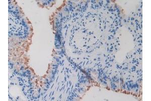 DAB staining on IHC-P; Samples: Mouse Lung Tissue (Secretin antibody  (AA 26-133))
