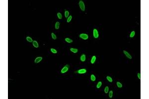 Immunofluorescent analysis of Hela cells using ABIN7139167 at dilution of 1:100 and Alexa Fluor 488-congugated AffiniPure Goat Anti-Rabbit IgG(H+L)