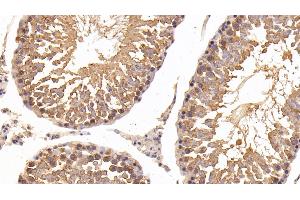 Immunohistochemistry (IHC) image for anti-Heat Shock Protein 90kDa alpha (Cytosolic), Class A Member 1 (HSP90AA1) (AA 698-732) antibody (ABIN7443815)