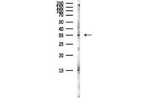 anti-Tropomyosin-2 (TPM2) (C-Term) antibody