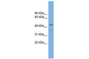 RDH16 anticorps  (AA 215-264)