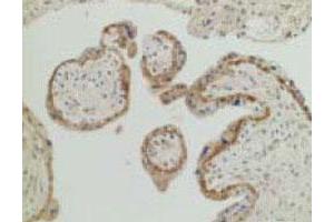 SEMA3B anticorps